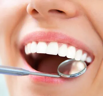 dental mirror next to woman's smiling mouth, reflecting tooth colored dental fillings Newark, CA dentist