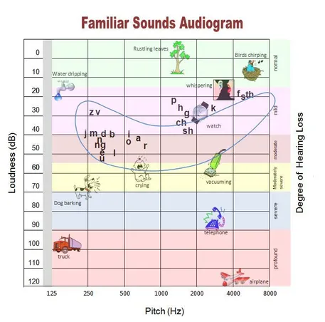 Clark Audiology & Hearing Aid Center - Plymouth Meeting, PA Clark