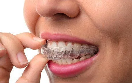 Teeth Whitening Richmond