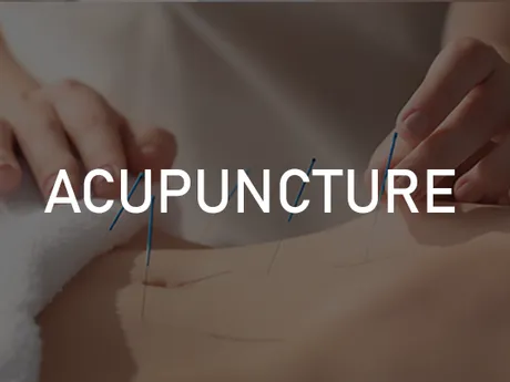 acupuncture