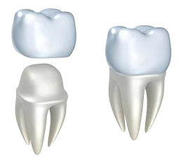 3D computer illustration of dental crown being placed over molar tooth, dental crowns Kanata, ON dentist