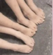 foot_pic_multiple.jpg