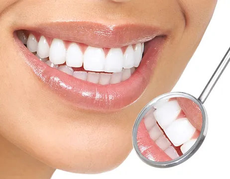 Dental Veneers | Dentist In Kansas, MO | Dr. Bellem