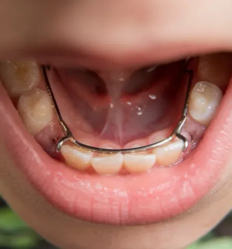Smiling at the Dentist
