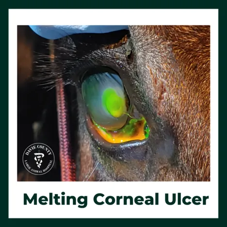 MeltingCornealUlcer