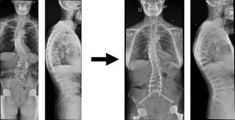 xray