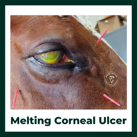 Meltingcornealulcer