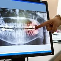 digital x-ray on computer screen, Melrose dentist