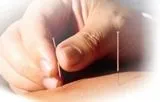 acupuncture_500.jpg