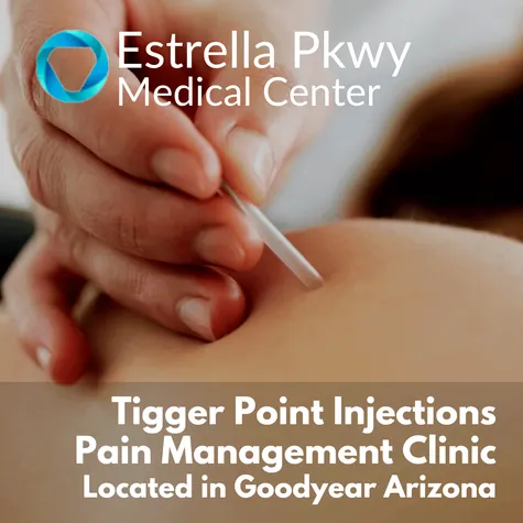 TRIGGER POINT INJECTIONS IN GOODYEAR, ARIZONA