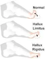 foot and ankle illustration