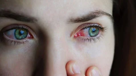 Woman's eye with red veins