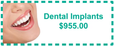 Dental Implants Special - El Paso TX
