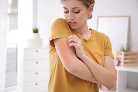 Women scratching arm