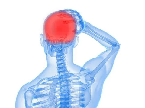 Diagram showing head pain