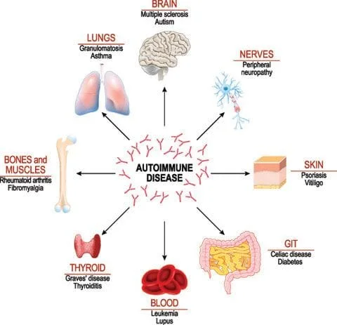 Diagram of autoimmune diseases