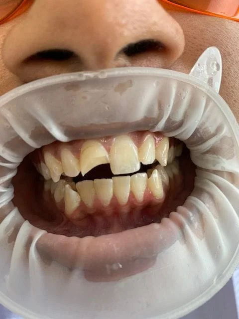 Smile 2 - Best Dentist Fairfax, VA