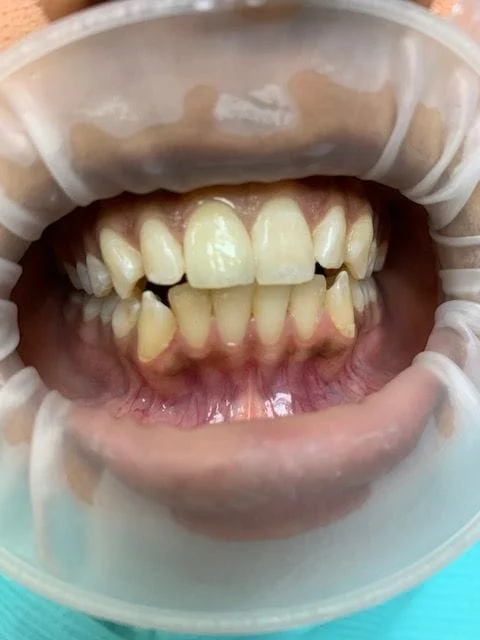 Smile1 - Best Dentist Fairfax, VA