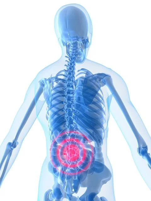 Illustration showing lower back pain