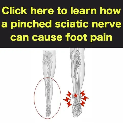 sciatica causing foot pain