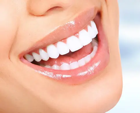 teeth whitening 