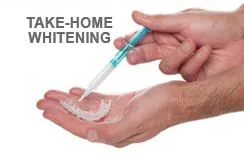 Teeth Whitening Options.
