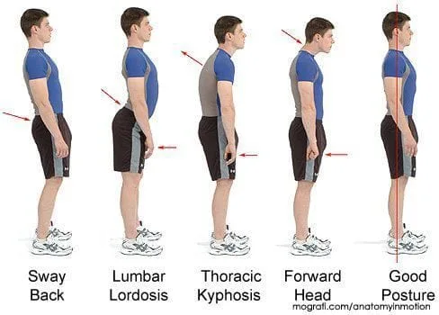 posture and spinal correction exercise graphic