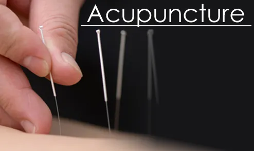 Acupuncture