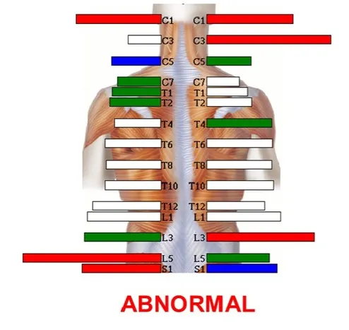 abnormalscan