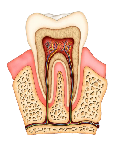 Root Canal Westminster