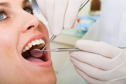 teen girl with mouth open, dentist hands holding dental tools examining her teeth, dentist Encinitas, CA