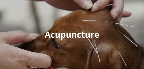 acupuncture