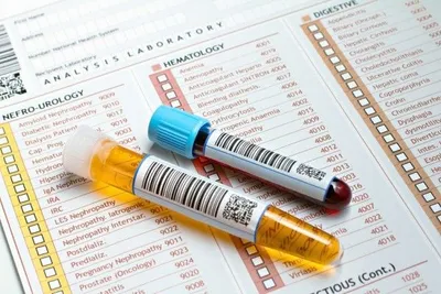 Holistic Health Center - Holistic Health Center In Grand Blanc, MI USA :: Functional  Blood Analysis