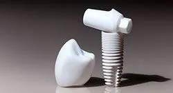 Dental Implant Materials