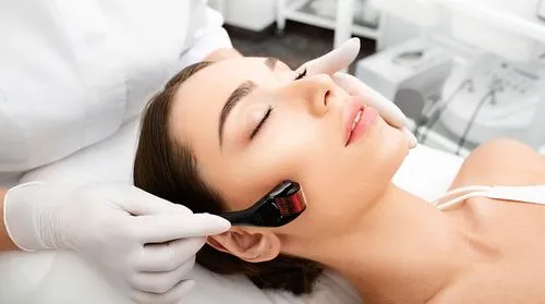 microneedling