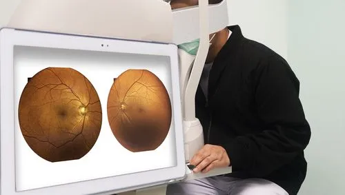 Optical Coherence Tomography