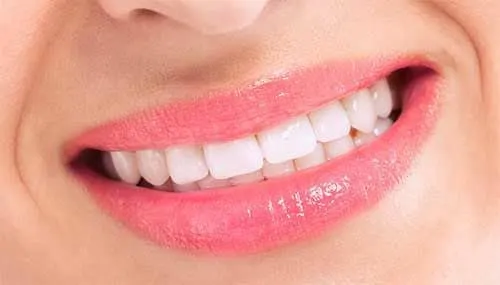 After Cosmetic Dentistry - Dentist Brooksville FL