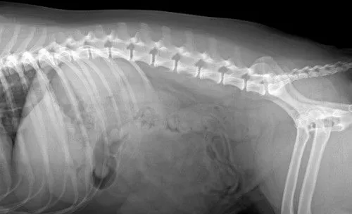 Before Surgery (arrow shows stones)