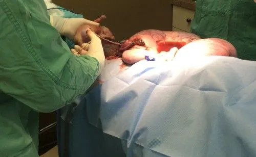 First puppy being delivered