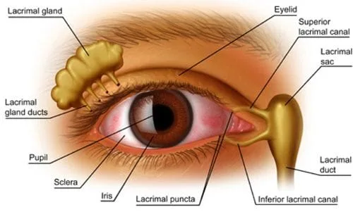 What is dry eye syndrome?