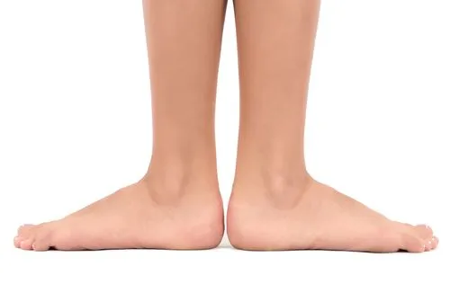 Illustration of flat feet on a persons feet