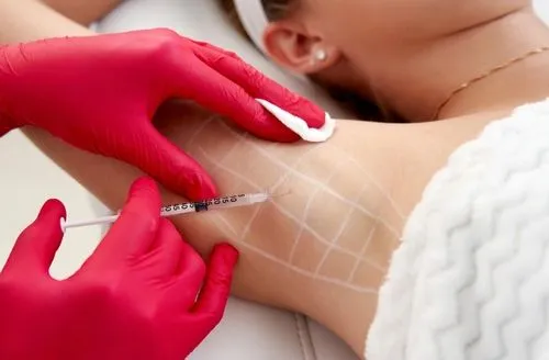Woman receiving injectable treatment for excessive sweating in the armpits