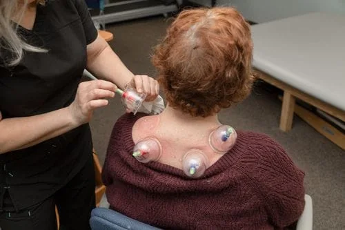 Myofascial CUpping AHP Physical Therapy norwalk ct