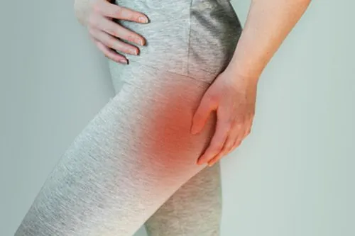 Sciatica-FAQs-in-Germantown-TN