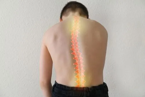man with scoliosis