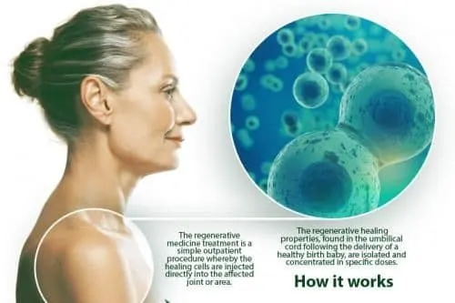 How Stem Cell Therapy Works Mount Pleasant