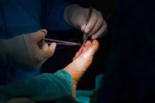 Surgeon performing foot and ankle operation in clinical setting.