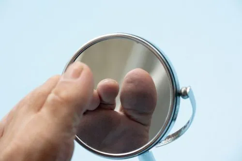 A patient using a mirror to examine their foot for cuts, sores, or wounds related to diabetes.