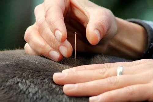 Doctor using acupuncture needle
