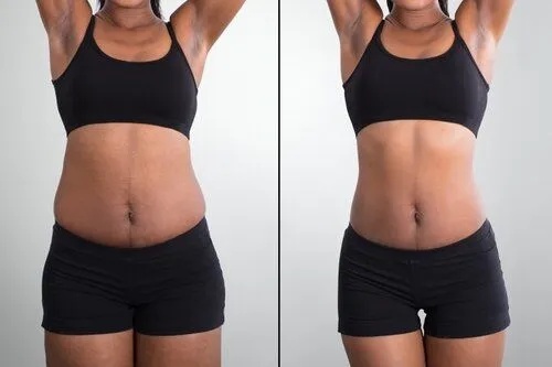tirzepatide mg ml What Is Tirzepatide? How It Works & What to Expect